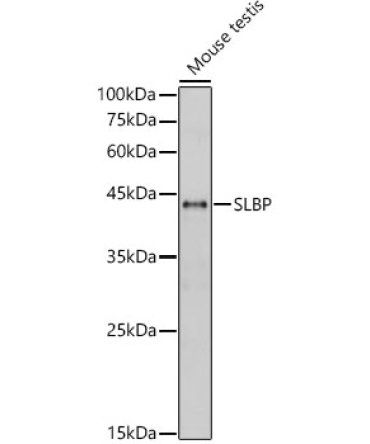 SLBP Rabbit Polyclonal Antibody