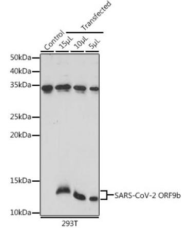 SARS-CoV-2 ORF9b Rabbit Polyclonal Antibody