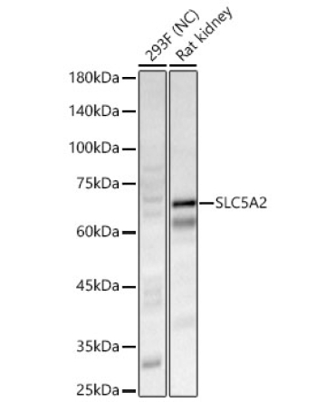 SLC5A2 Rabbit Polyclonal Antibody