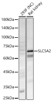 SLC5A2 Rabbit Polyclonal Antibody