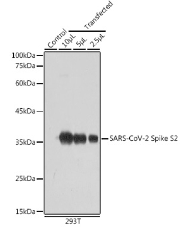 SARS-CoV-2 Spike S2 Rabbit Polyclonal Antibody
