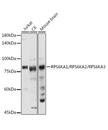 RPS6KA1/RPS6KA2/RPS6KA3 Rabbit Polyclonal Antibody