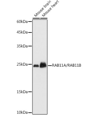 RAB11A/RAB11B Rabbit Polyclonal Antibody