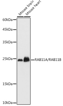 RAB11A/RAB11B Rabbit Polyclonal Antibody
