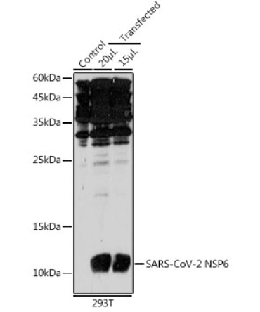 SARS-CoV-2 NSP6 Rabbit Polyclonal Antibody