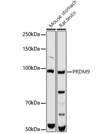 PRDM9 Rabbit Polyclonal Antibody