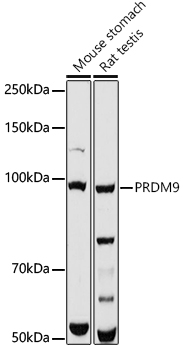PRDM9 Rabbit Polyclonal Antibody