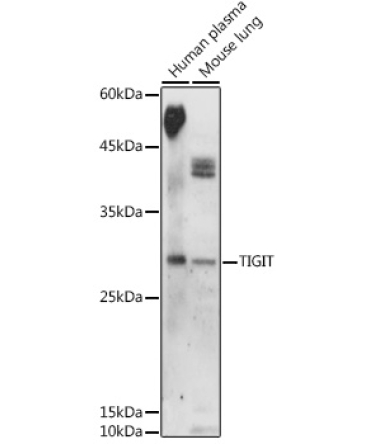 TIGIT Rabbit Polyclonal Antibody