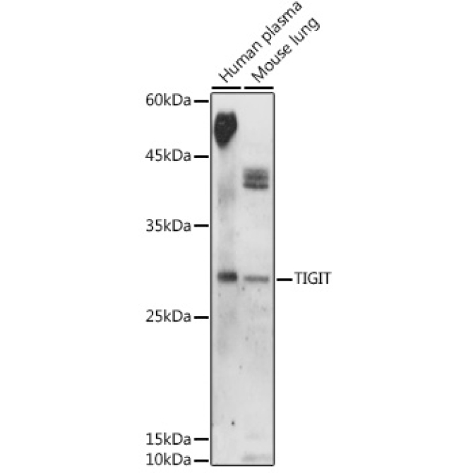 TIGIT Rabbit Polyclonal Antibody