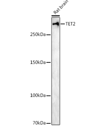 TET2 Rabbit Polyclonal Antibody
