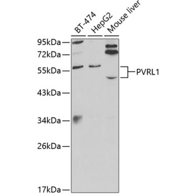 PVRL1 Rabbit Polyclonal Antibody