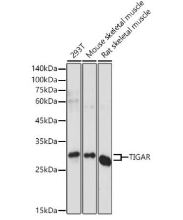 TIGAR Rabbit Polyclonal Antibody
