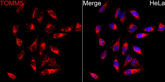 TOMM5 Rabbit Polyclonal Antibody