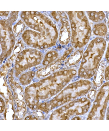 PPP1R3C Rabbit Polyclonal Antibody