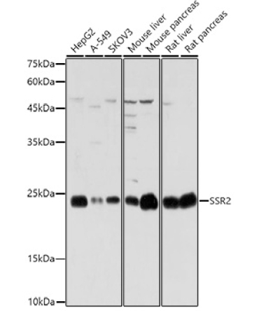 SSR2 Rabbit Polyclonal Antibody