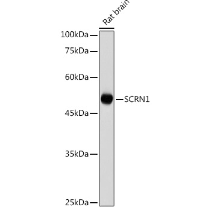 SCRN1 Rabbit Polyclonal Antibody