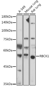 RBCK1 Rabbit Polyclonal Antibody