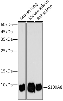 S100A8 Rabbit Polyclonal Antibody