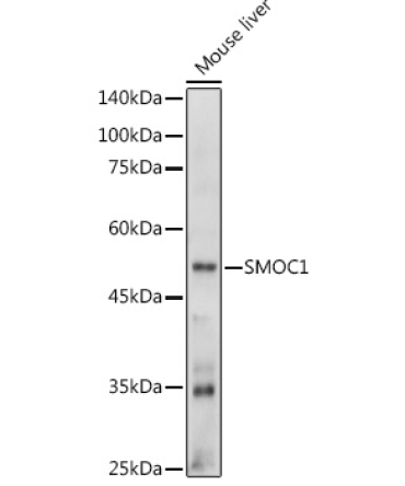 SMOC1 Rabbit Polyclonal Antibody