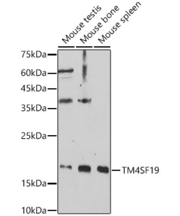TM4SF19 Rabbit Polyclonal Antibody