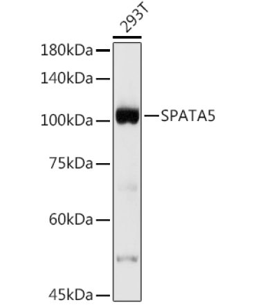 SPATA5 Rabbit Polyclonal Antibody