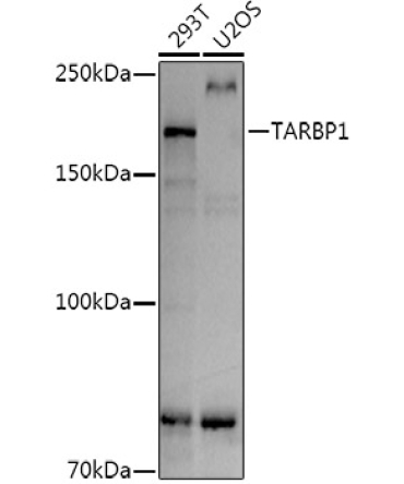 TARBP1 Rabbit Polyclonal Antibody