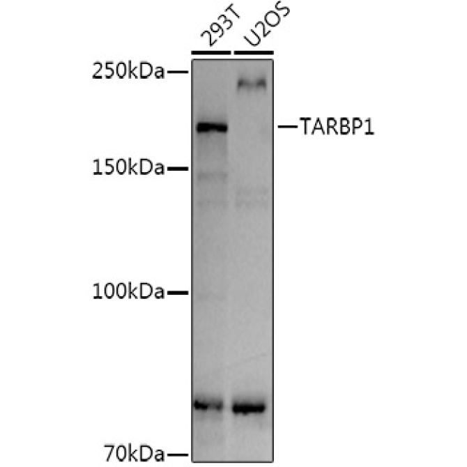 TARBP1 Rabbit Polyclonal Antibody