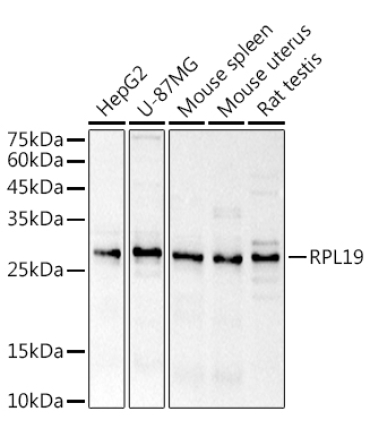RPL19 Rabbit Polyclonal Antibody