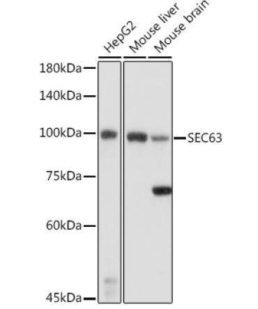SEC63 Rabbit Polyclonal Antibody