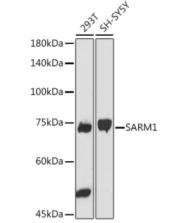 SARM1 Rabbit Polyclonal Antibody