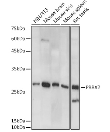 PRRX2 Rabbit Polyclonal Antibody
