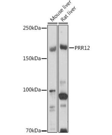 PRR12 Rabbit Polyclonal Antibody