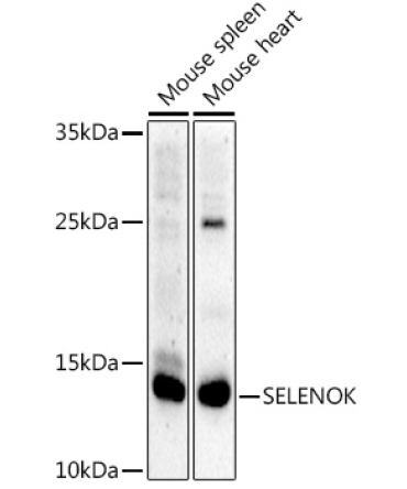 SELENOK Rabbit Polyclonal Antibody