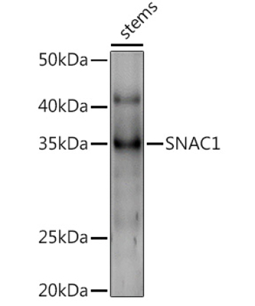 SNAC1 Rabbit Polyclonal Antibody