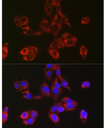 RPL39 Rabbit Polyclonal Antibody
