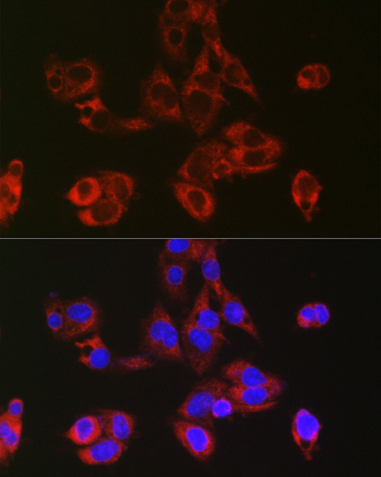 RPL39 Rabbit Polyclonal Antibody