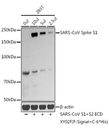 SARS-CoV-2 Spike S1 Rabbit Polyclonal Antibody