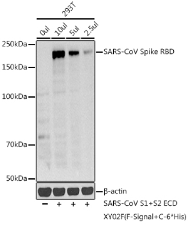 SARS-CoV Spike RBD Rabbit Polyclonal Antibody