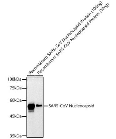 SARS-CoV-2 N Protein Rabbit Polyclonal Antibody