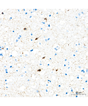 Somatostatin (SST) Rabbit Monoclonal Antibody