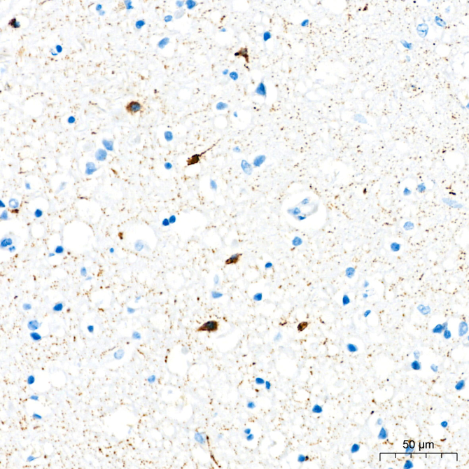 Somatostatin (SST) Rabbit Monoclonal Antibody