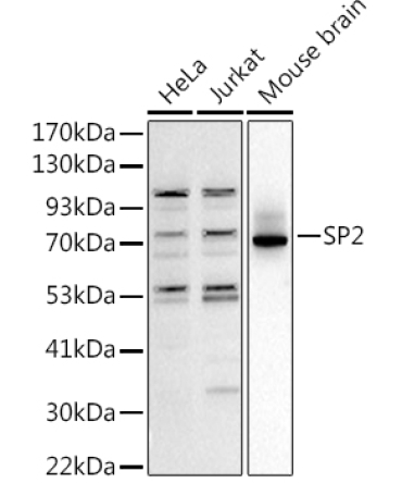 SP2 Rabbit Polyclonal Antibody