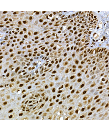 SCAF4 Rabbit Polyclonal Antibody