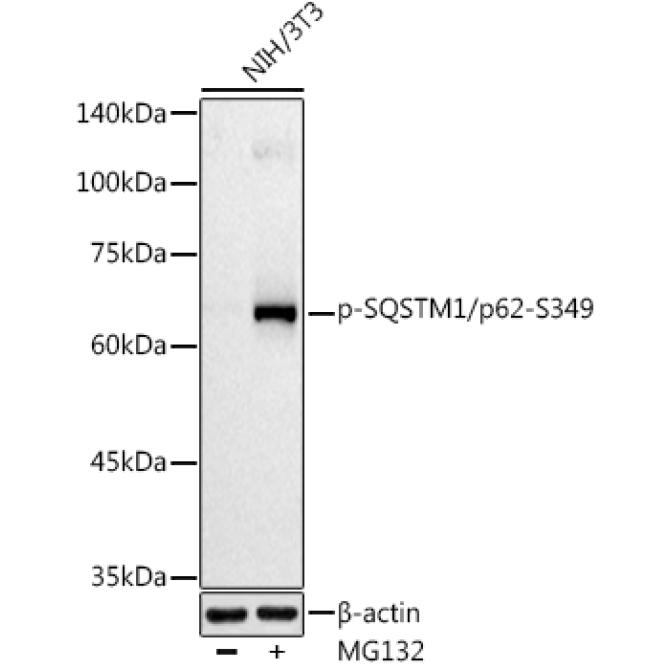 Phospho-SQSTM1/p62-S349 Rabbit Polyclonal Antibody
