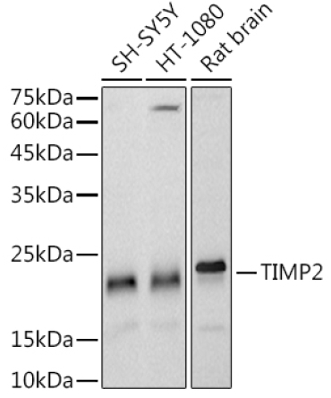 TIMP2 Rabbit Monoclonal Antibody