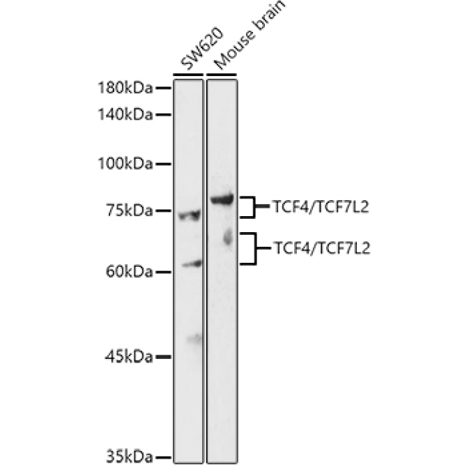 TCF4/TCF7L2 Rabbit Polyclonal Antibody