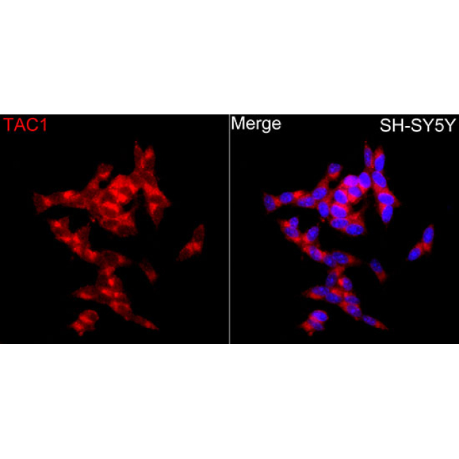 Substance P Rabbit Polyclonal Antibody