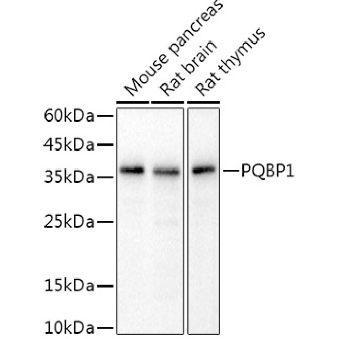 PQBP1 Rabbit Monoclonal Antibody