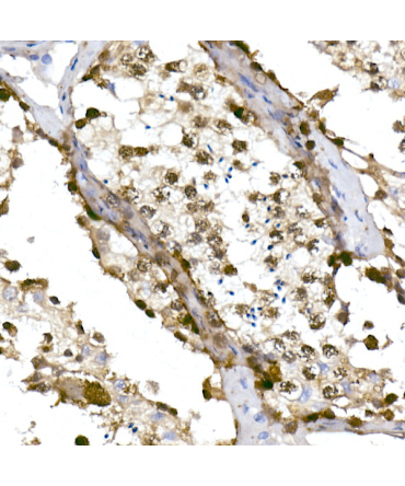 TET1 Rabbit Monoclonal Antibody