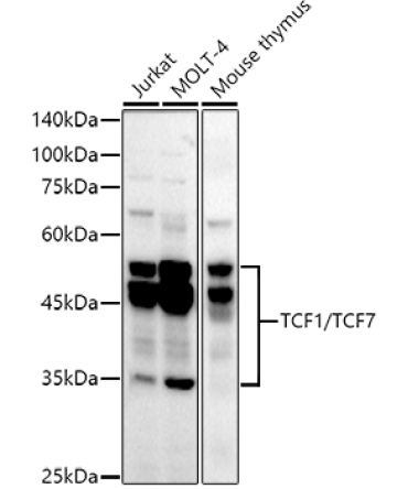 TCF1/TCF7 Rabbit Monoclonal Antibody